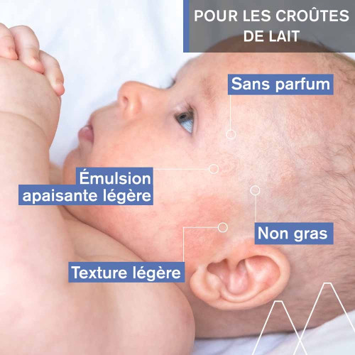 Soin Bébé Uriage 40ml - Apaise et Régule Croûtes de Lait