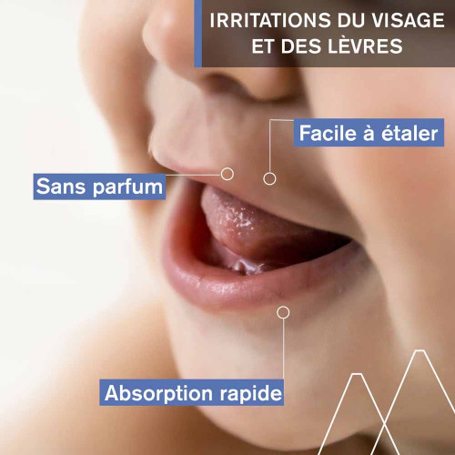 Uriage Bébé 1er Soin Péri-Oral 30ml - Apaise et Répare