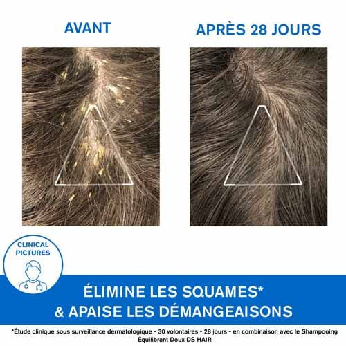 Uriage DS Hair Shampoing 150ml - Apaise et Purifie le Cuir Chevelu