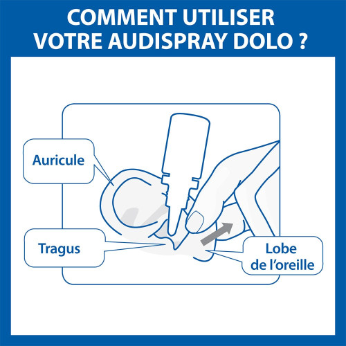 Dolo Douleur de L'oreille 1 flacon