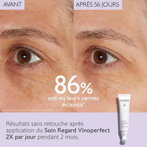 Vinoperfect Soin Éclaircissant Regard 15 ml