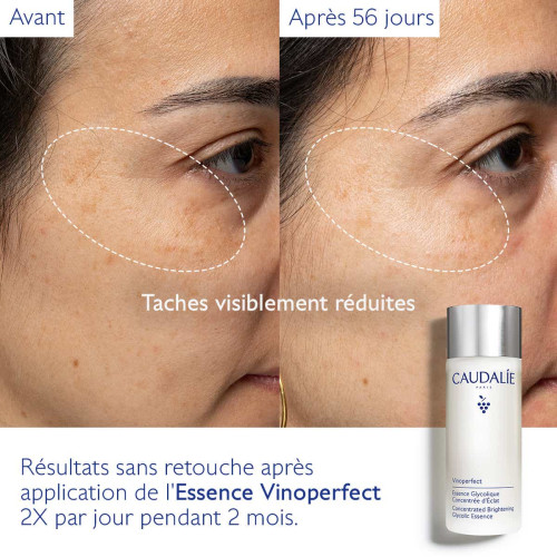 Vinoperfect Essence Glycolique Concentrée d'Éclat 100 ml