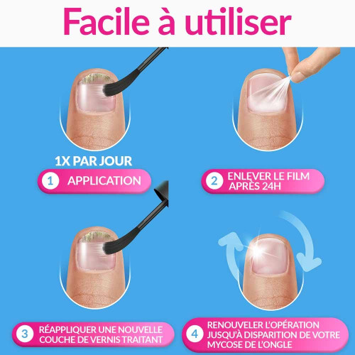 Excilor Forte Mycose Ongle 30ml - Traitement Efficace 3 Temps