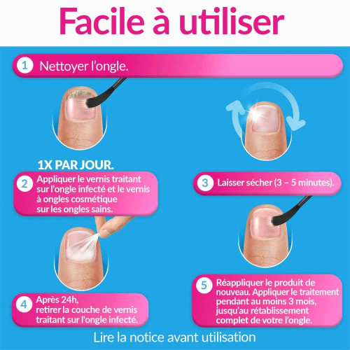 Traitement mycose de l'ongle forte Nude 30ml