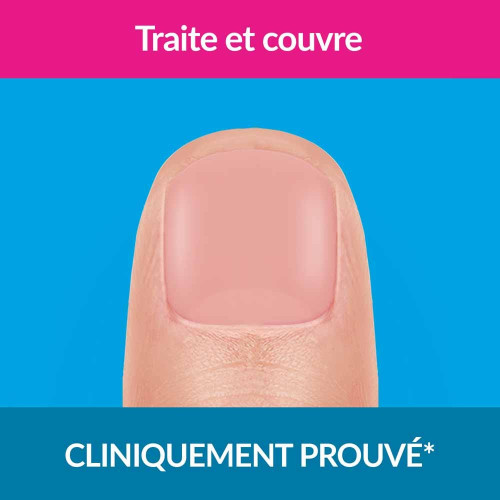 Traitement mycose de l'ongle forte Nude 30ml