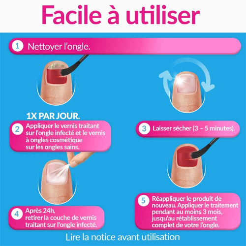 Traitement mycose de l'ongle forte rouge corail 30 ml