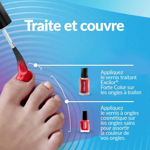 Traitement mycose de l'ongle forte rouge corail 30 ml