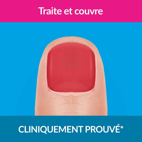 Traitement mycose de l'ongle forte rouge corail 30 ml