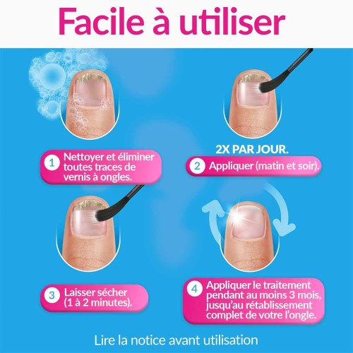 Traitement contre la mycose de l'ongle 3,3 ml