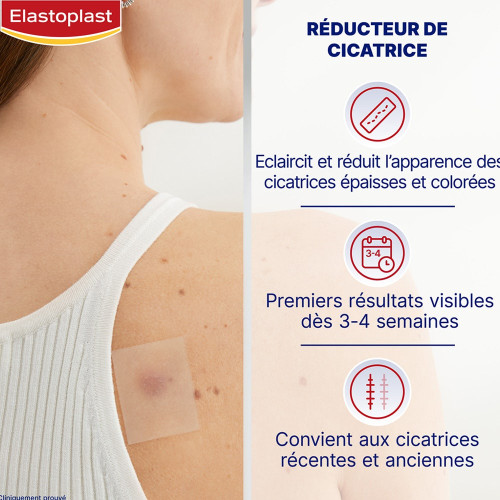 Elastoplast Réducteur de Cicatrices 21 Patchs Réduit Rougeur