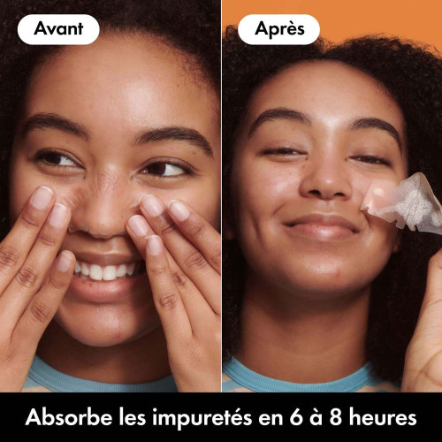 Hero Mighty Patch Nose 10 Patchs Peau Nette Nuit - Parapharmacie en ligne