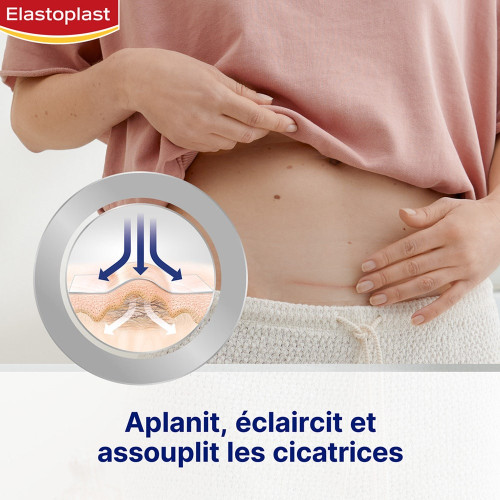 Elastoplast Réducteur Cicatrices XL 21 Pansements Efficace Discret