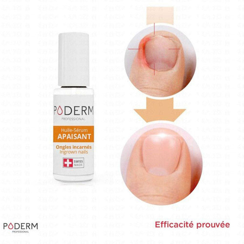 PODERM Huile-Sérum Apaisante 8ml - Soin Ongles Sensibles Naturel
