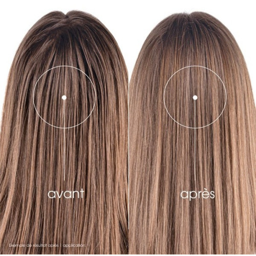Shampoing sec Klorane Ortie+Vit E - Nettoyage express cheveux gras