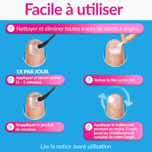 EXCILOR FORTE Sol Ongle : Traitement Puissant Mycose 24h