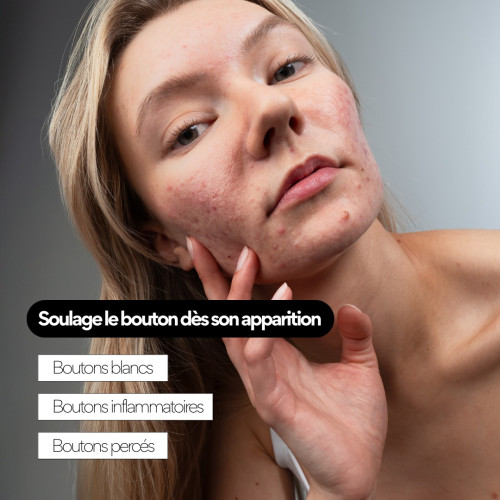 Soin Stop Boutons SKIN&OUT : Anti-inflammatoire et maturant