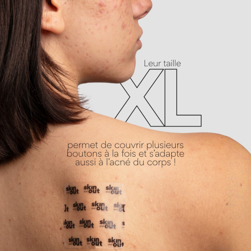 Patch XL Boutons Skin&Out : Cicatrise & Élimine les Boutons Rapidement