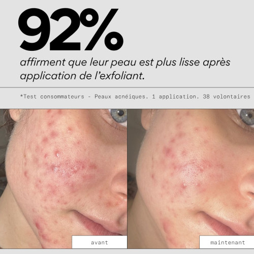 Masque exfoliant Peel OUT : Éclat & Pores nets en 10 min