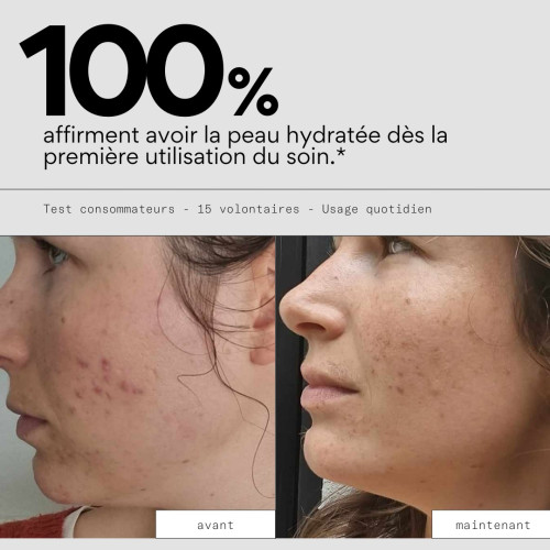 Crème hydratante SKIN&OUT pour peaux imperfections - 99% naturel