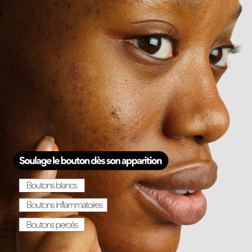 Patchs anti-boutons SKIN&OUT : 23 patchs cicatrisation rapide