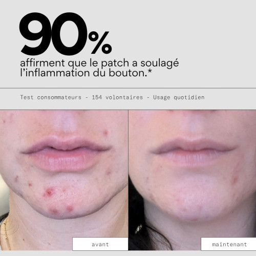 Patchs anti-boutons SKIN&OUT : 23 patchs cicatrisation rapide