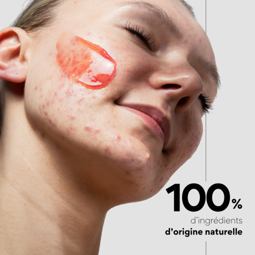 Masque SOS Boutons Skin&Out : Apaisement naturel contre l'acné