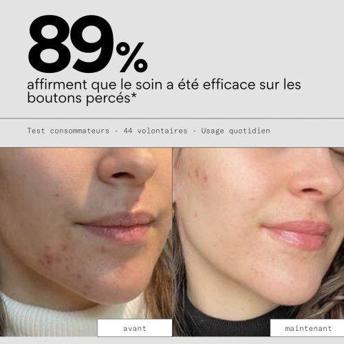 Soin Réparateur CICA OUT : Cicatrise & Apaise les Boutons Percés