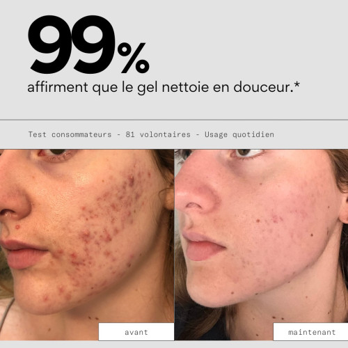 Nettoyant Clean OUT SKIN&OUT : Élimine imperfections, équilibre sébum