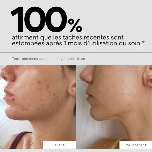 SKIN&OUT Anti-Taches : Atténue taches brunes et rouges en 2 mois
