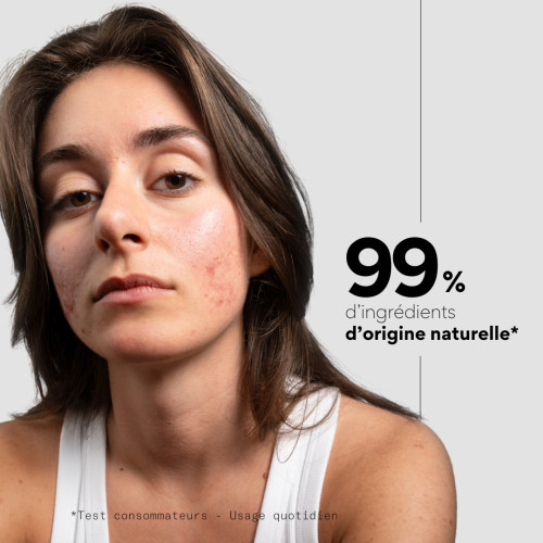 SKIN&OUT Anti-Taches : Atténue taches brunes et rouges en 2 mois