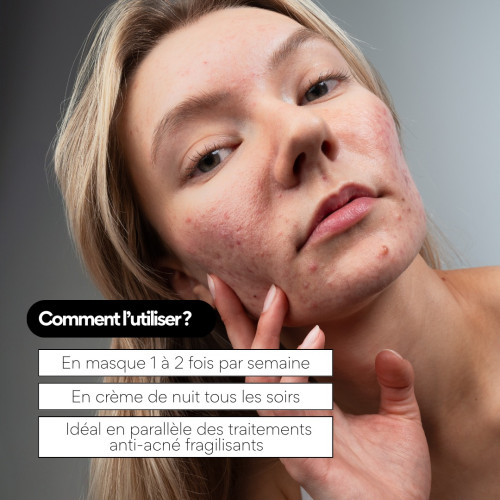 SKIN&OUT Masque Nuit Répar : Cicatrisation & Hydratation Profonde