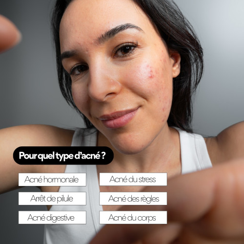 STOP BOUTON SKIN&OUT : Contrôlez l'acné adulte naturellement