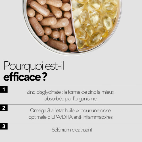 STOP BOUTON SKIN&OUT : Contrôlez l'acné adulte naturellement