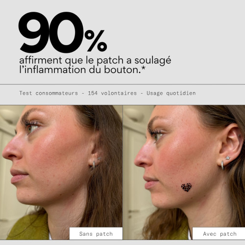 Patch boutons Léopard SKIN&OUT : Cicatrise & absorbe