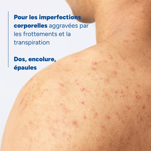 Ducray Keracnyl Spray Corps : Anti-Boutons Asséchant en 2 Jours