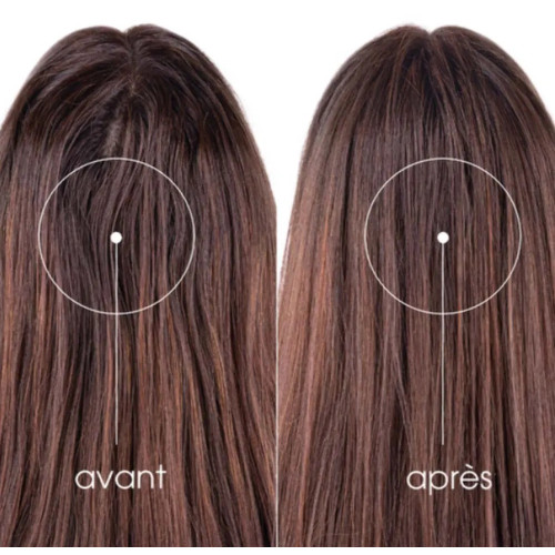 Klorane Shampoing Sec Ortie - Spray 150 mL : Propreté en 2 min