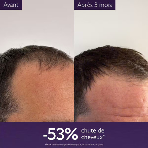 Caudalie Sérum Anti-Chute : Cheveux plus denses et pousse stimulée