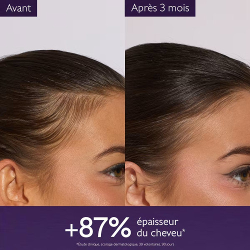 Caudalie Sérum Anti-Chute : Cheveux plus denses et pousse stimulée