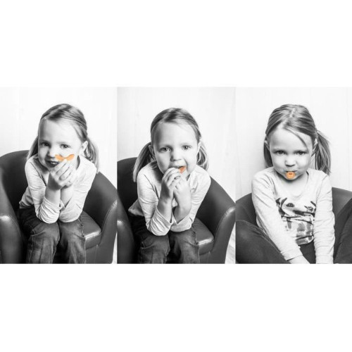 Dispositif 1ère Dentition Sevrage des Succions 2-6 ans