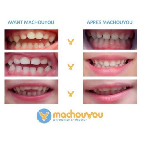 Dispositif 1ère Dentition Sevrage des Succions 2-6 ans