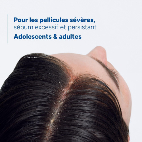 Ducray Kelual DS : Nettoyage profond, cuir sain et cheveux légers