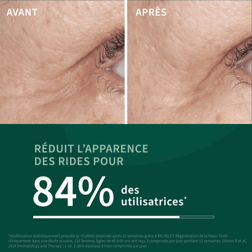 Régénération de la peau 28 sticks