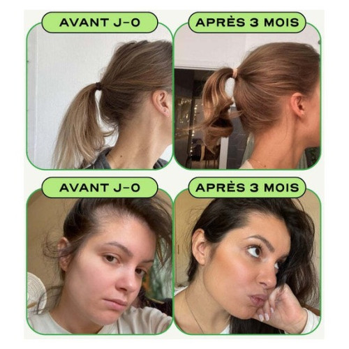 Circles GROW : Complément anti-chute cheveux - Vitamines & minéraux