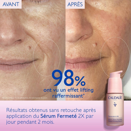 Resveratrol [Lift] Sérum Liftant Fermeté 30 ml