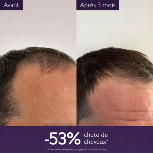 Caudalie Sérum Anti-Chute : Cheveux plus denses et pousse stimulée