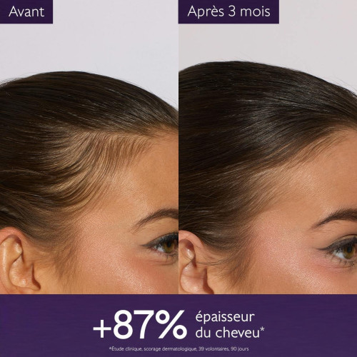 Caudalie Sérum Anti-Chute : Cheveux plus denses et pousse stimulée