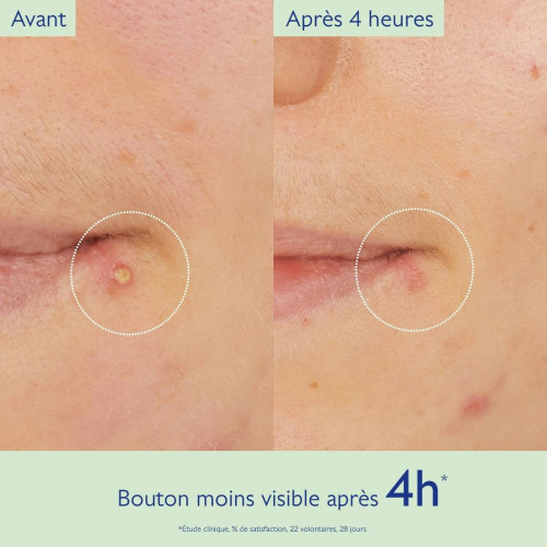 Caudalie Vinopure Stop Boutons 15ml Anti-imperfections Rapide Pharma360
