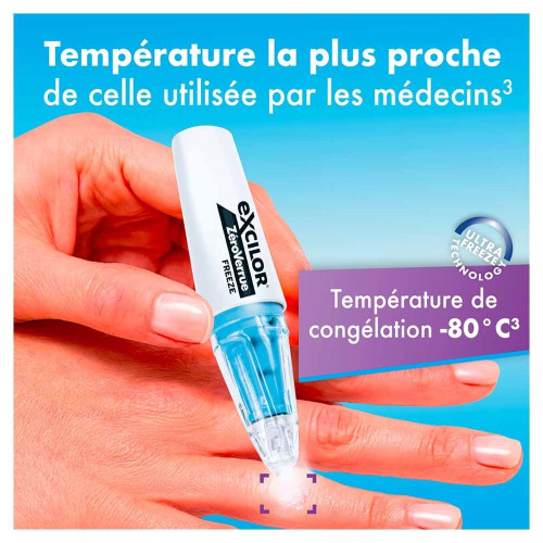 ZéroVerrue Freeze Excilor : Éliminez les verrues en -80°C à domicile
