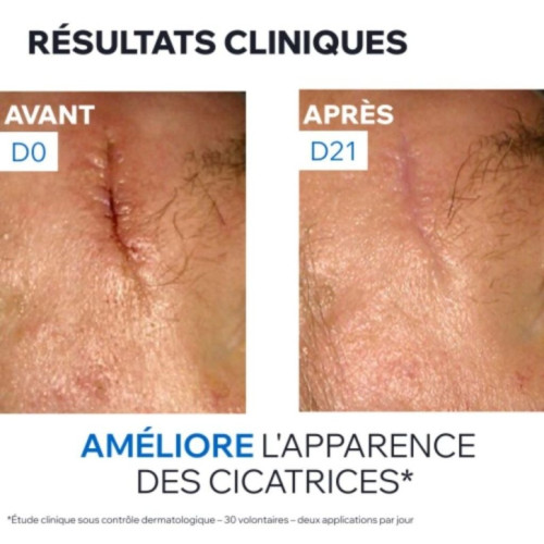 Uriage Bariéderm Cica+ : Crème réparatrice peau irritée & fragilisée