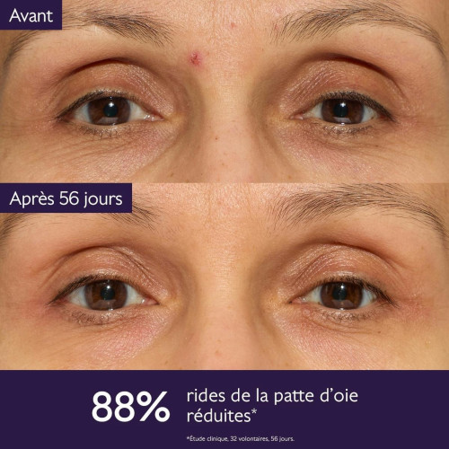 Caudalie Coffret Anti-Âge Global : Solution Globale Anti-Âge